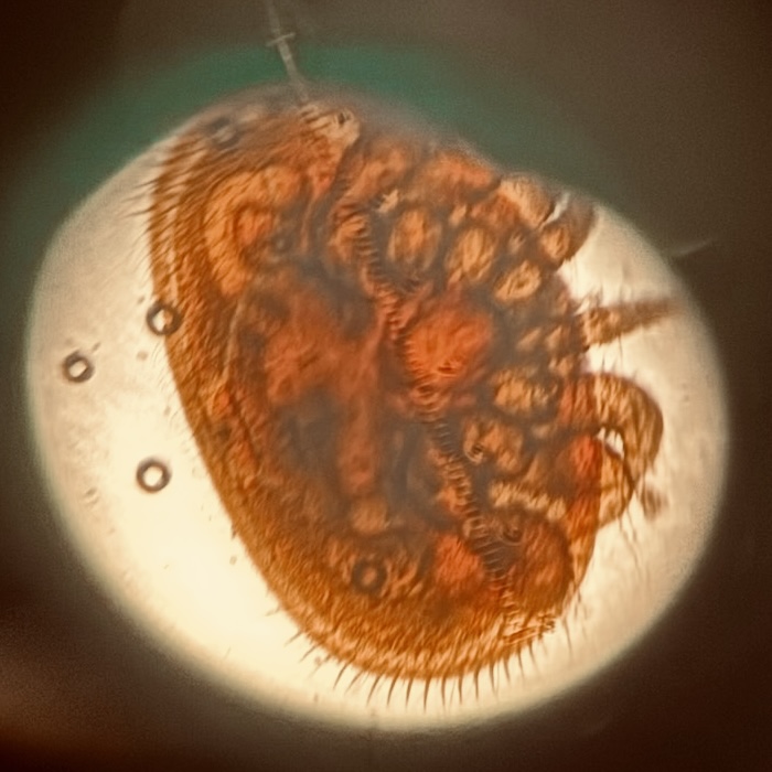 varroa mite under a microscope