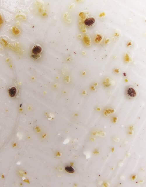 Mite Count